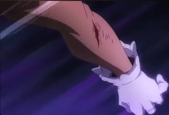 Source: My Hero Academia (2016 anime) mha_arm